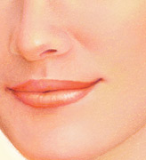 Lip Augmentation, After