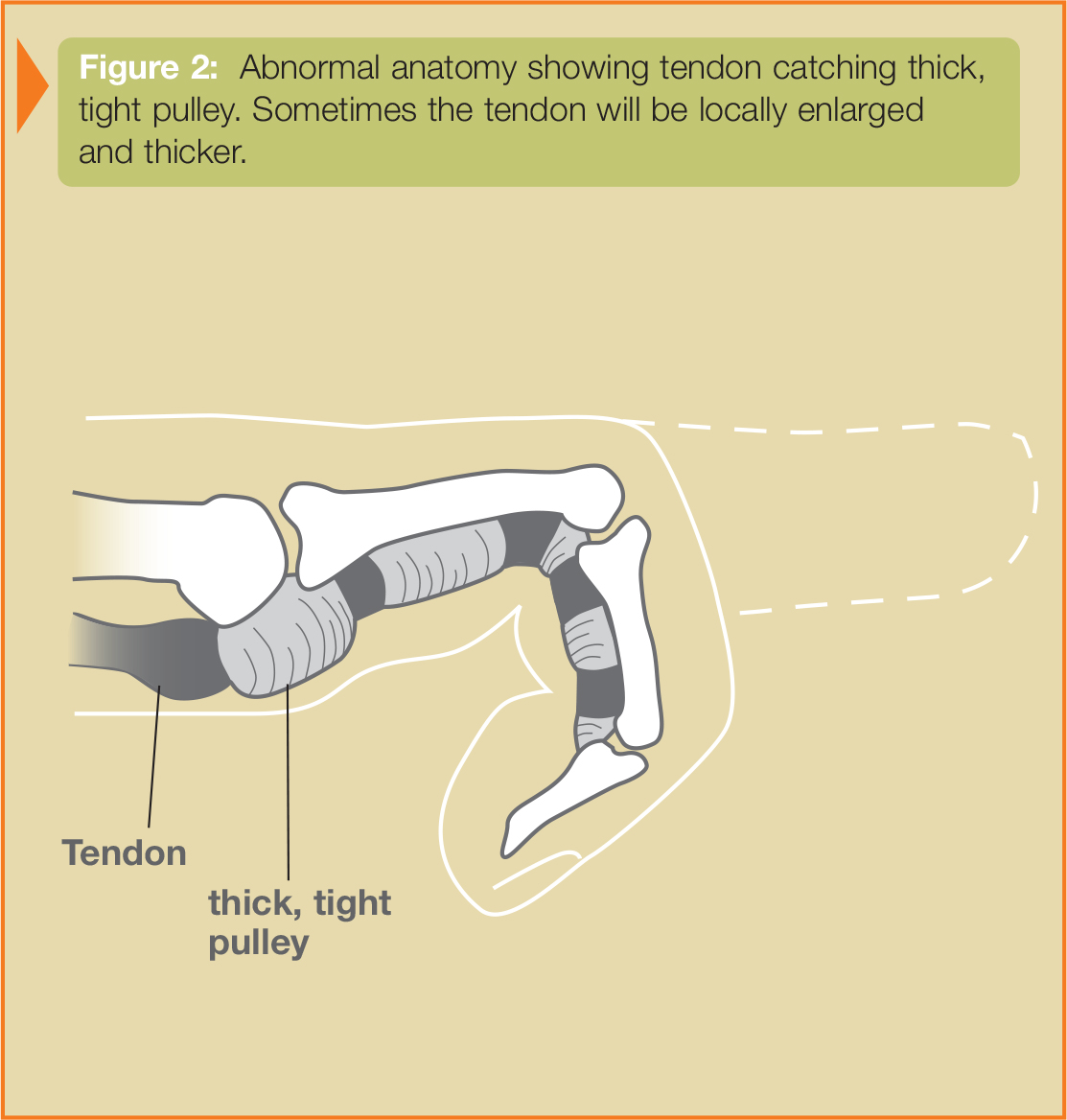 Thick tight hotsell